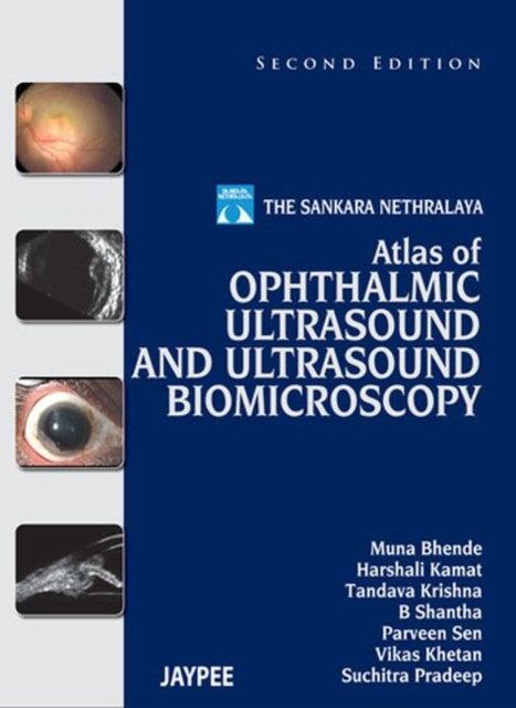 Atlas of Ophthalmic Ultrasound and Ultrasound Biomicroscopy, Hardback Book
