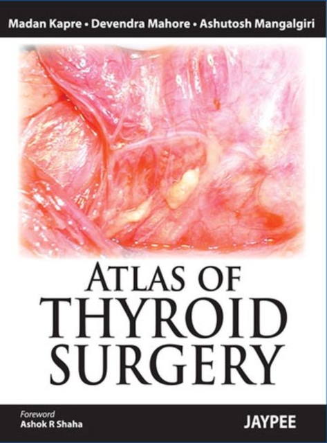 Atlas of Thyroid Surgery, Hardback Book