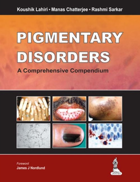 Pigmentary Disorders : A Comprehensive Compendium, Hardback Book
