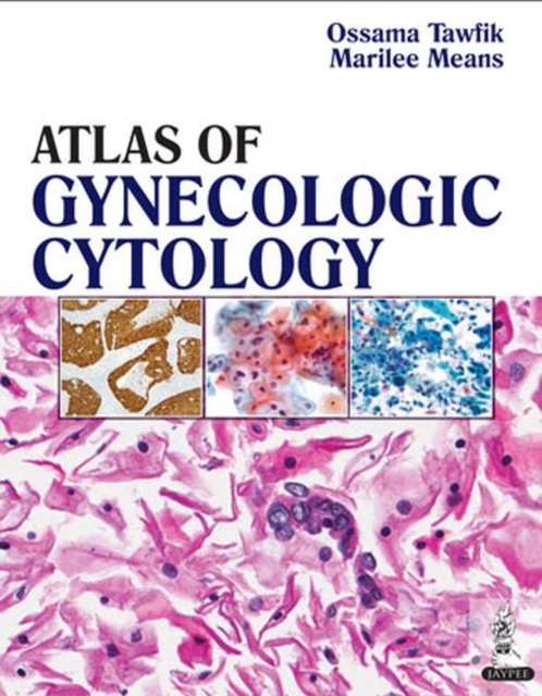 Atlas of Gynecologic Cytology, Hardback Book