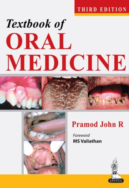 Textbook of Oral Medicine, Paperback / softback Book