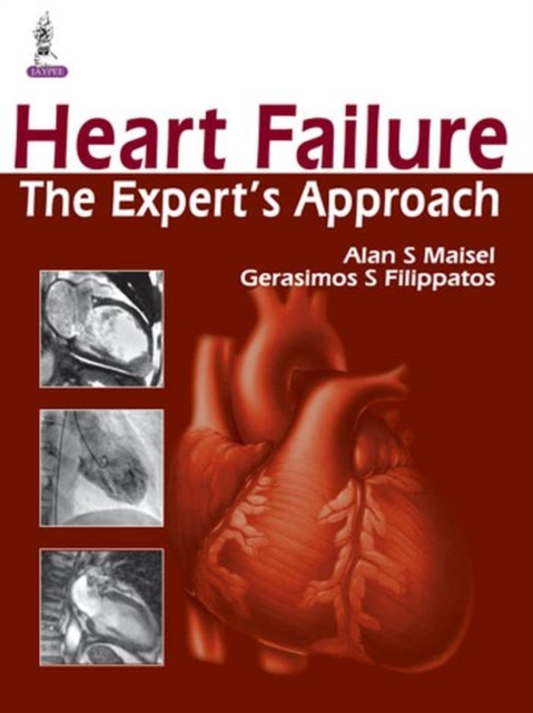 Heart Failure : The Expert's Approach, Hardback Book