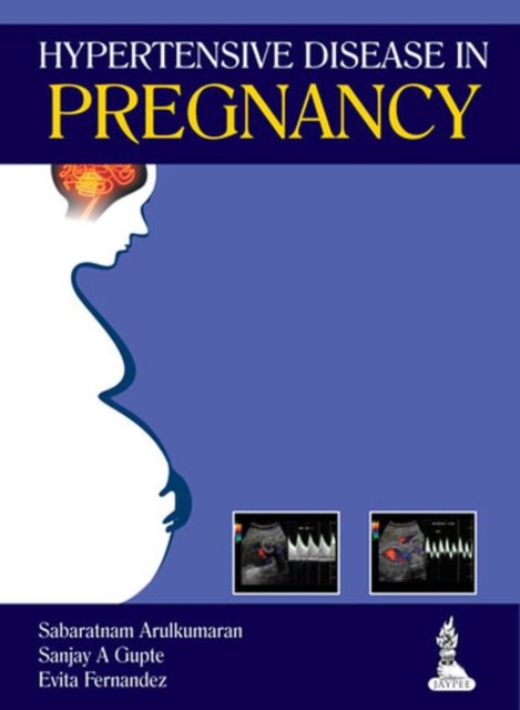 Hypertensive Disease in Pregnancy, Paperback / softback Book