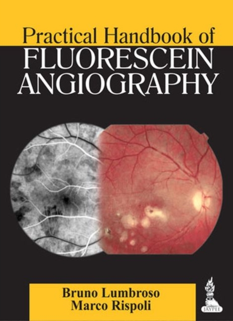 Practical Handbook of Fluorescein Angiography, Paperback / softback Book