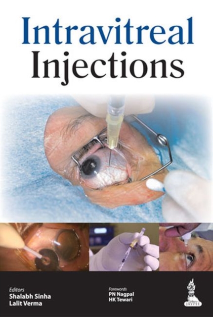 Intravitreal Injections, Paperback / softback Book