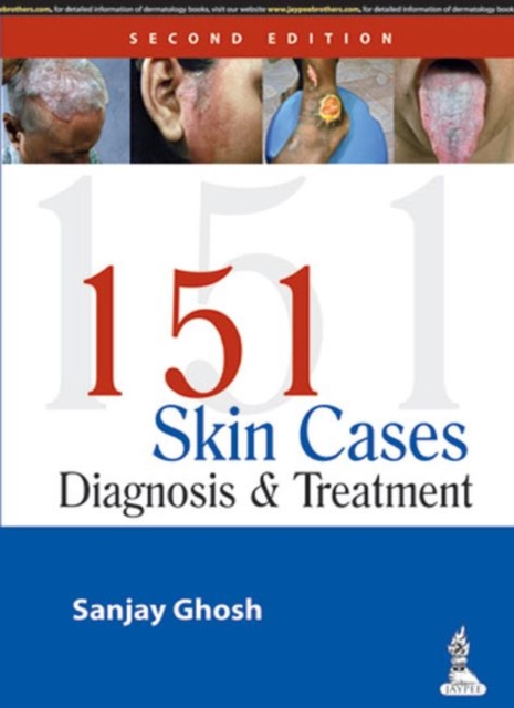 151 Skin Cases : Diagnosis & Treatment, Paperback / softback Book
