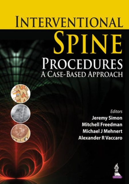 Interventional Spine Procedures : A Case-Based Approach, Hardback Book