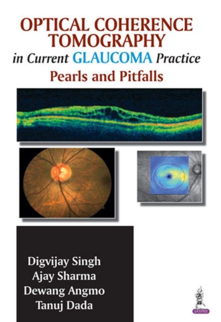 Optical Coherence Tomography in Current Glaucoma Practice : Pearls and Pitfalls, Paperback / softback Book