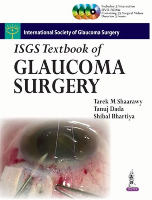 ISGS Textbook of Glaucoma Surgery, Hardback Book