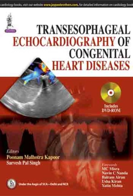 Transesophageal Echocardiography of Congenital Heart Diseases, Hardback Book