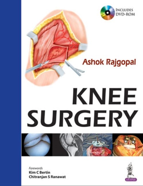 Knee Surgery, Hardback Book