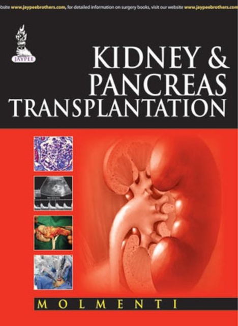 Kidney & Pancreas Transplantation, Hardback Book