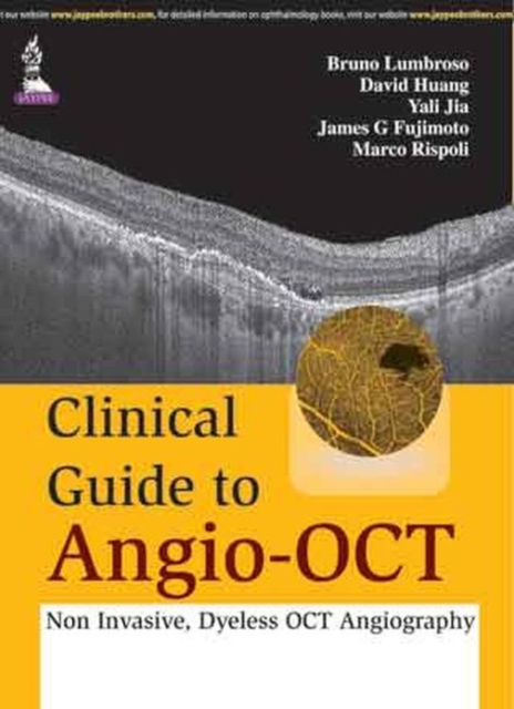 Clinical Guide to Angio-OCT: Non Invasive, Dyeless OCT Angiography, Hardback Book