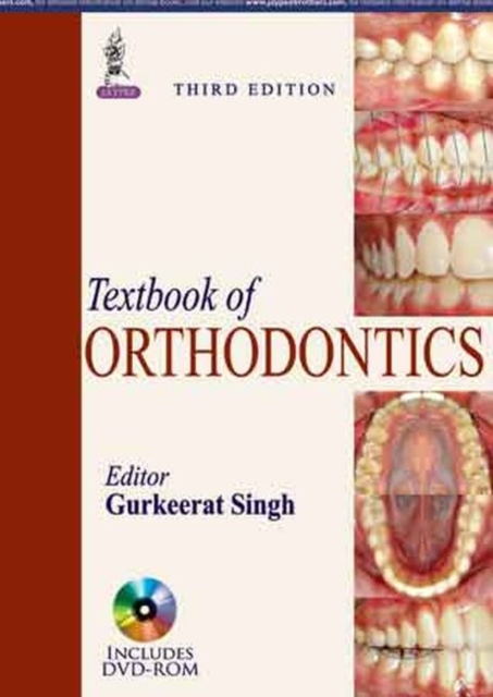 Textbook of Orthodontics, Paperback / softback Book