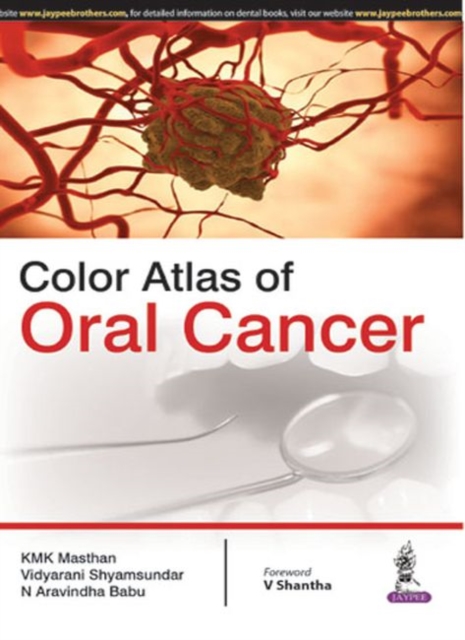 Color Atlas of Oral Cancer, Paperback / softback Book