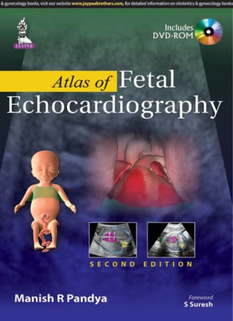 Atlas of Fetal Echocardiography, Hardback Book