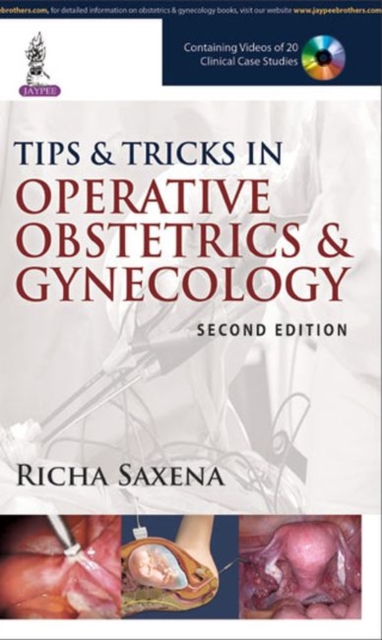 Tips & Tricks in Operative Obstetrics & Gynecology, Paperback / softback Book
