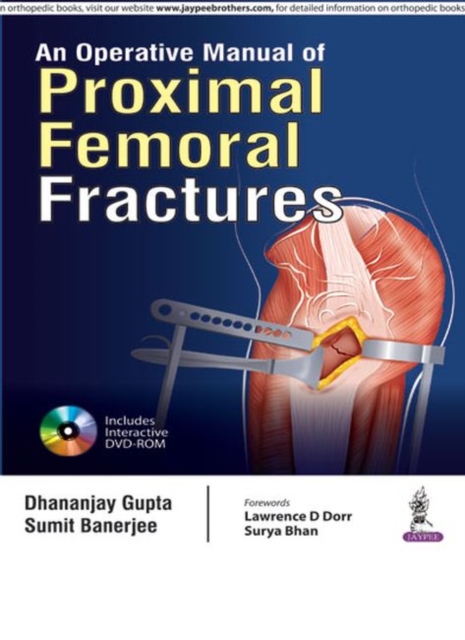 An Operative Manual of Proximal Femoral Fractures, Paperback / softback Book