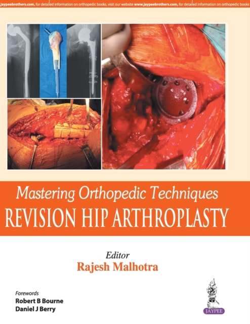 Mastering Orthopedic Techniques: Revision Total Hip Arthroplasty, Hardback Book