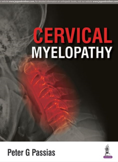 Cervical Myelopathy, Hardback Book