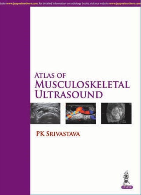 Atlas of Musculoskeletal Ultrasound, Hardback Book