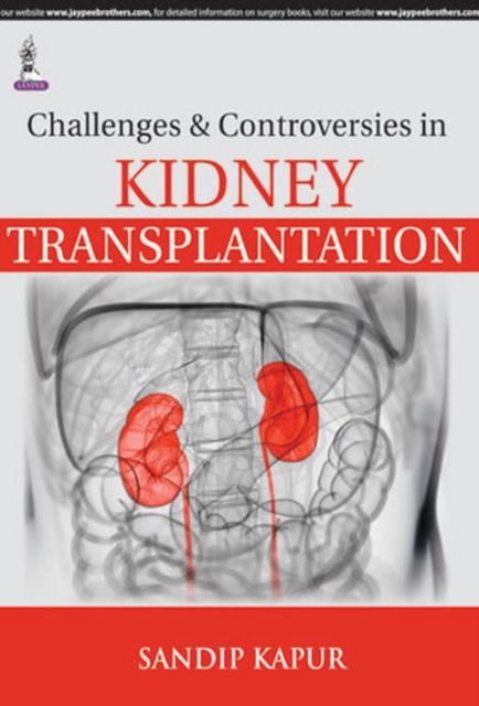 Challenges and Controversies in Kidney Transplantation, Hardback Book