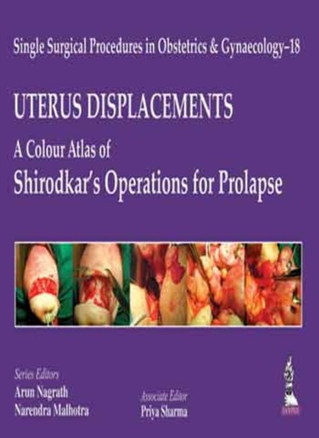 Single Surgical Procedures in Obstetrics and Gynaecology - 18: UTERUS DISPLACEMENTS: A Colour Atlas of Shirodkar's Operations for Prolapse, Hardback Book