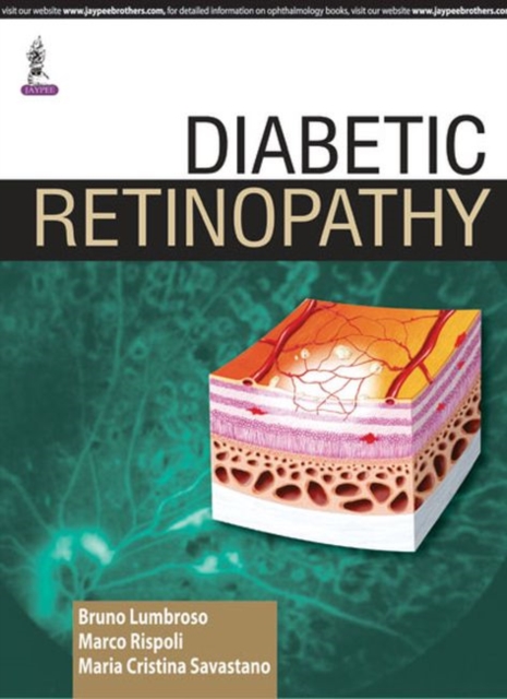 Diabetic Retinopathy, Hardback Book