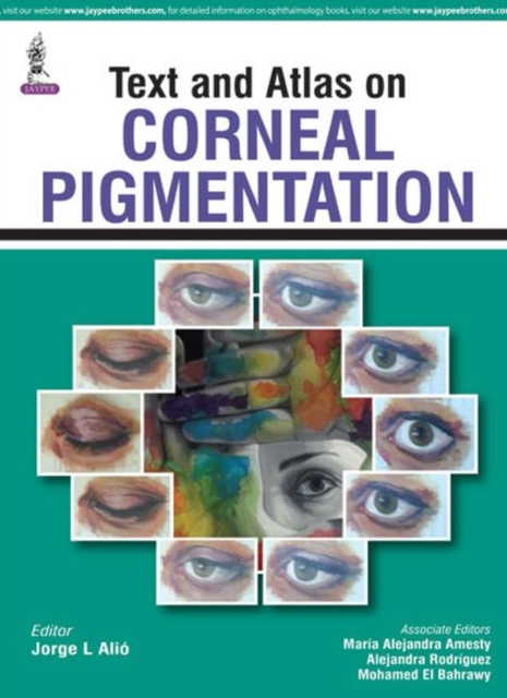 Text and Atlas on Corneal Pigmentation, Hardback Book