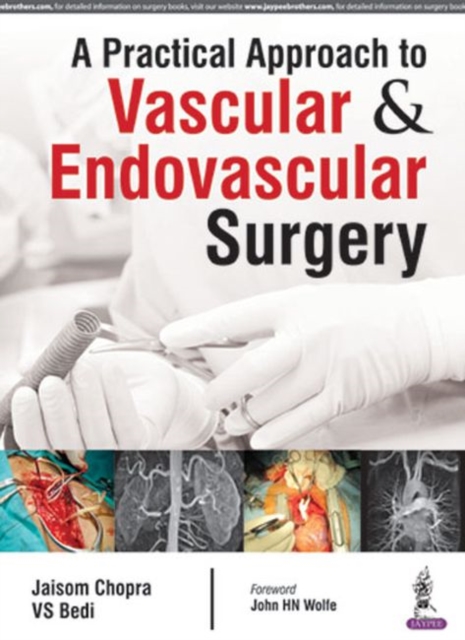 A Practical Approach to Vascular & Endovascular Surgery, Hardback Book