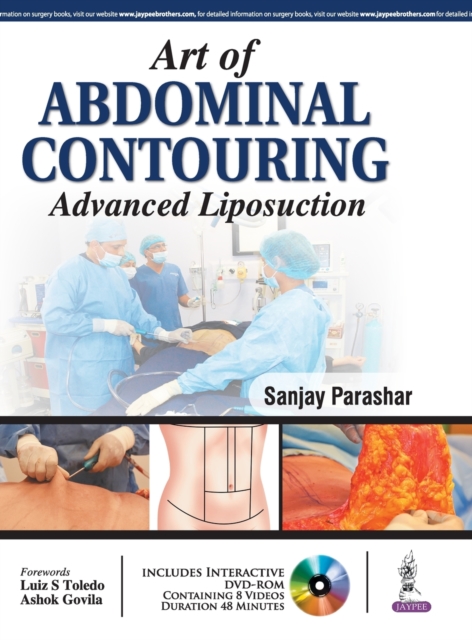 Art of Abdominal Contouring : Advanced Liposuction, Hardback Book