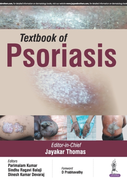 Textbook of Psoriasis, Paperback / softback Book
