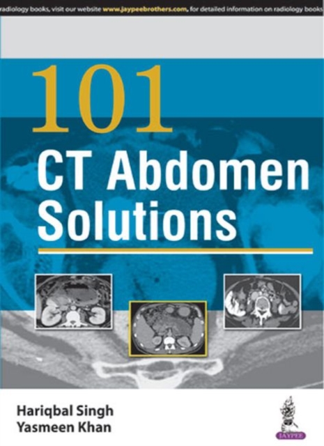 101 CT Abdomen Solutions, Paperback / softback Book