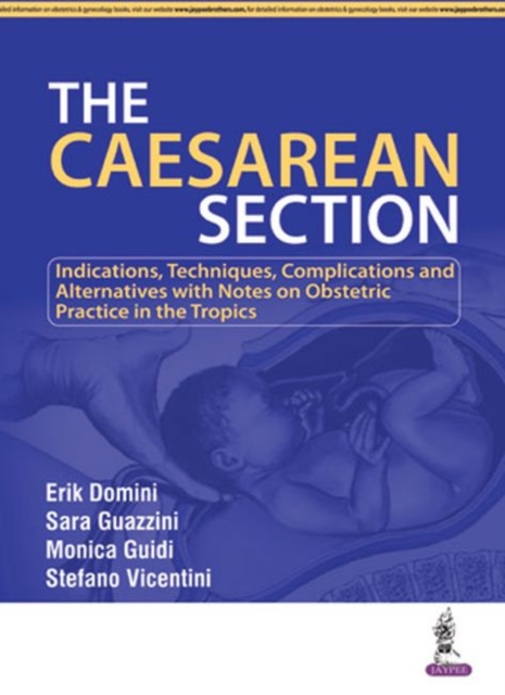 The Caesarean Section, Paperback / softback Book