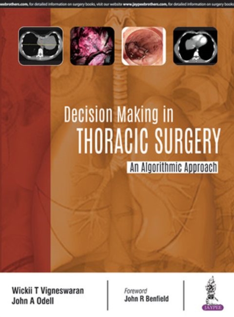 Decision Making in Thoracic Surgery : An Algorithmic Approach, Paperback / softback Book