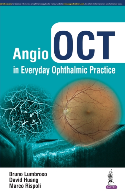 Angio OCT in Everyday Ophthalmic Practice, Hardback Book