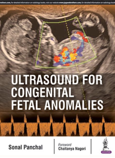 Ultrasound for Congenital Fetal Anomalies, Paperback / softback Book