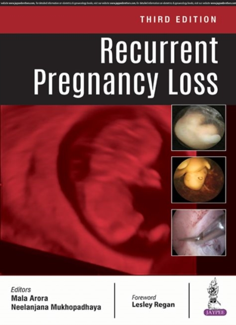 Recurrent Pregnancy Loss, Paperback / softback Book