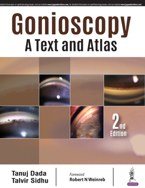 Gonioscopy: A Text and Atlas, Hardback Book