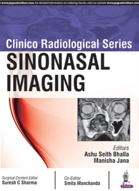 Clinico Radiological Series: Sinonasal Imaging, Paperback / softback Book