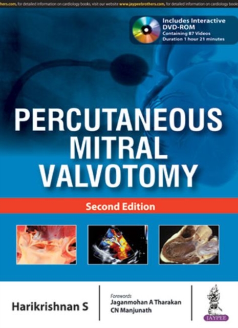 Percutaneous Mitral Valvotomy, Paperback / softback Book