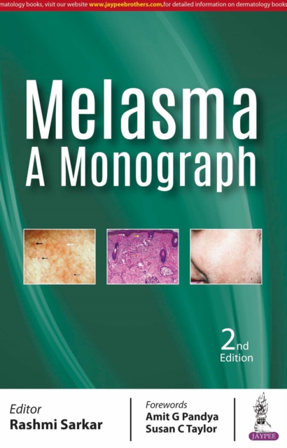 Melasma: A Monograph, Paperback / softback Book