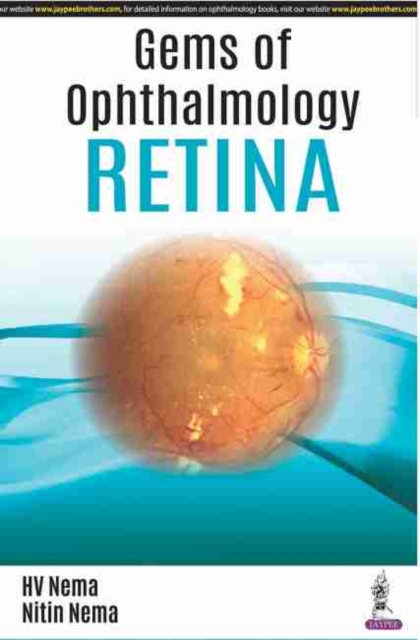 Gems of Ophthalmology: Retina, Paperback / softback Book