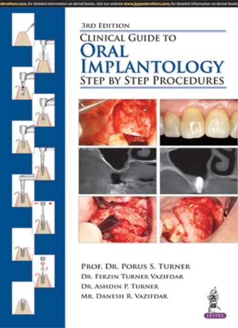 Clinical Guide to Oral Implantology : Step by Step Procedures, Paperback / softback Book