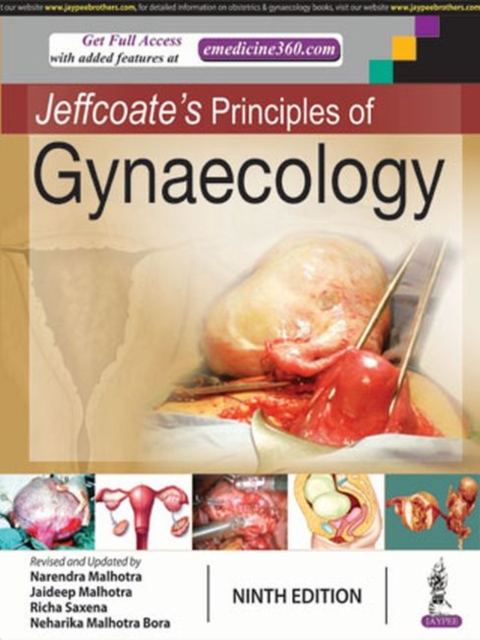 Jeffcoate's Principles of Gynaecology, Hardback Book