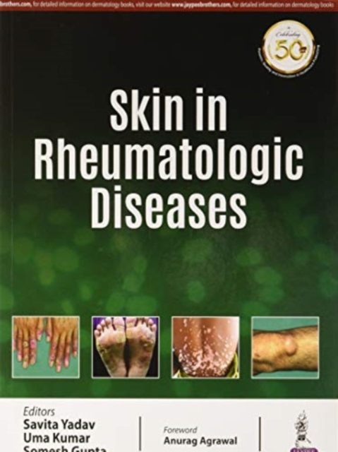 Skin in Rheumatologic Diseases, Paperback / softback Book