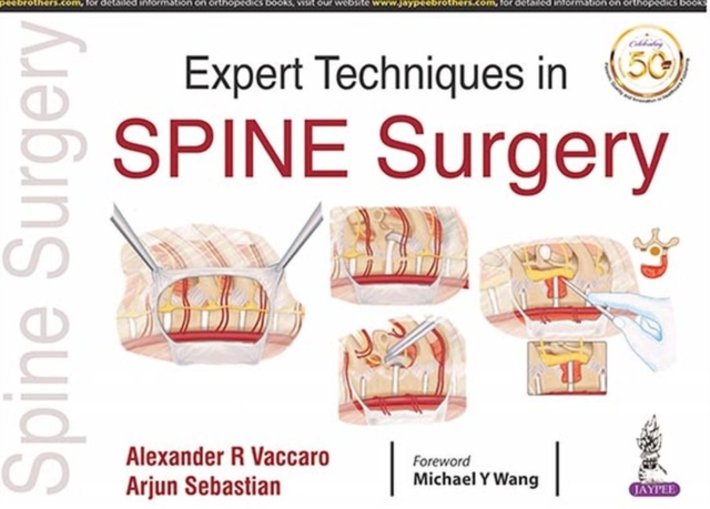 Expert Techniques in Spine Surgery, Paperback / softback Book