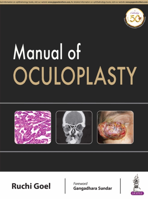 Manual of Oculoplasty, Paperback / softback Book