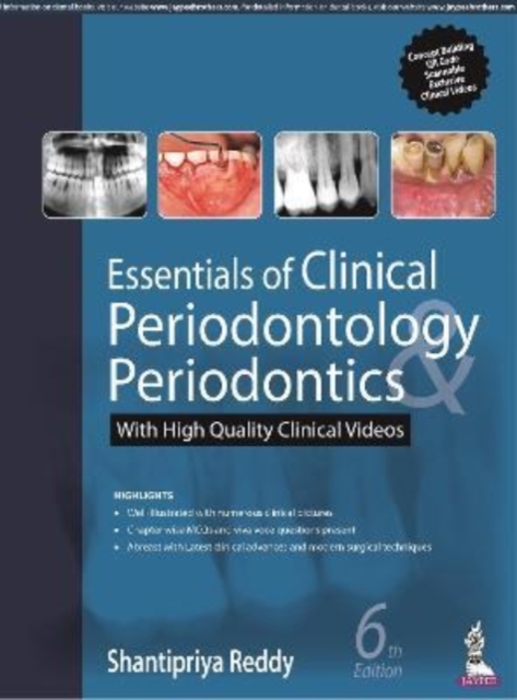 Essentials of Clinical Periodontology & Periodontics, Paperback / softback Book