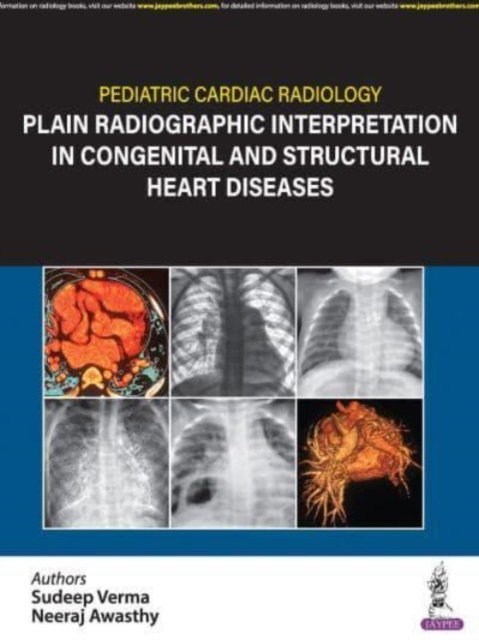 Pediatric Cardiac Radiology : Plain Radiographic Interpretation in Congenital and Structural Heart Diseases, Hardback Book
